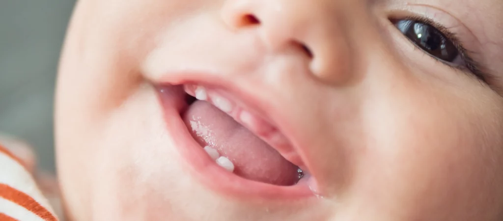 primeiro dente