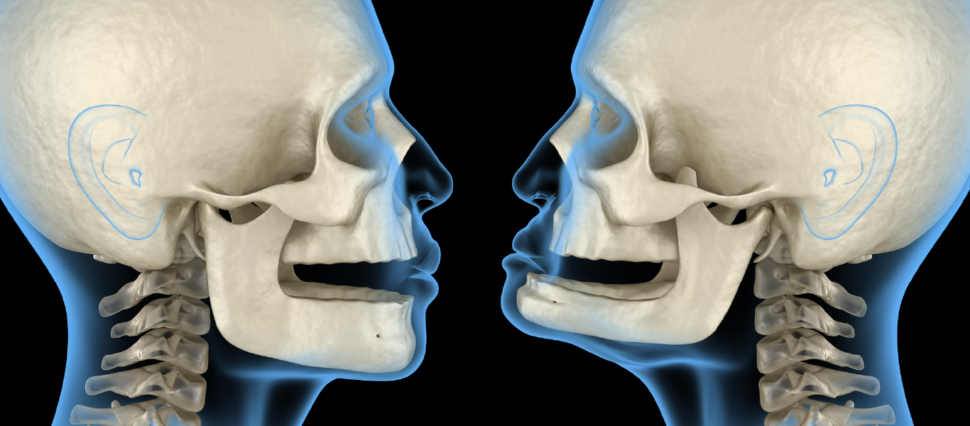 falta de dentes envelhece o rosto: ilustração 3D do crânio e do contorno facial